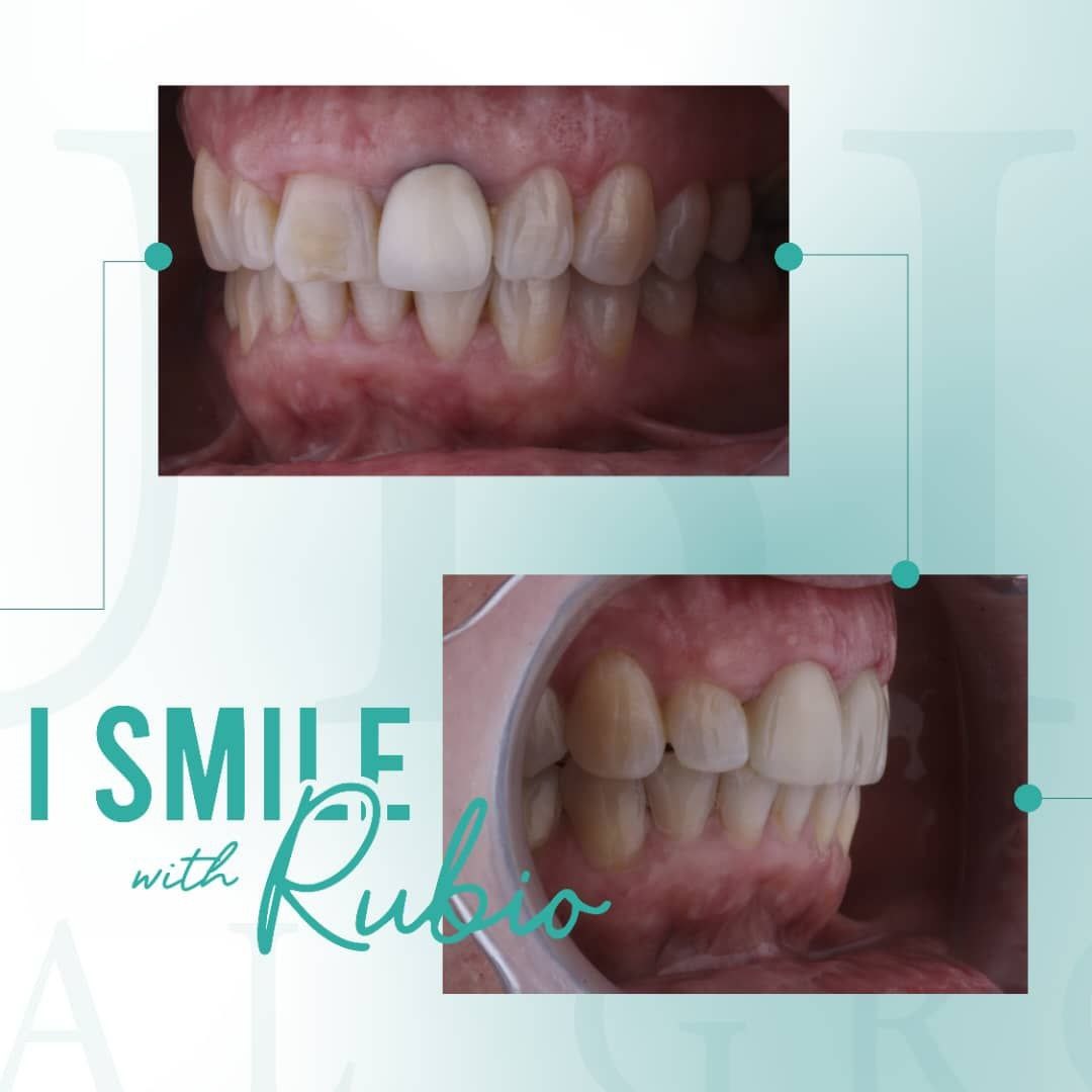 Best dentists in Mexico Rubio Dental Group