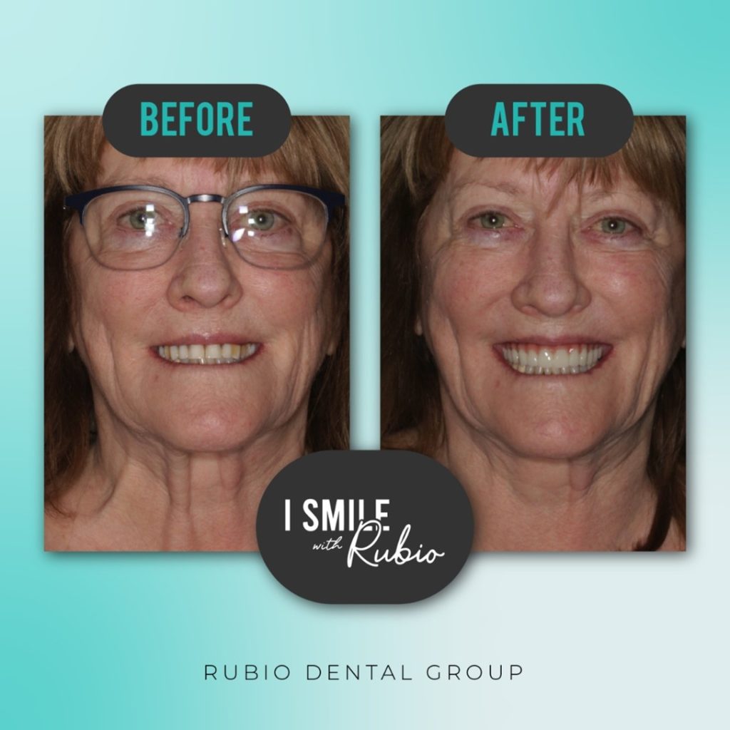 Dentist in Los Algodones Mexico Rubio Dental Group