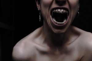 Blog 126 rubber-bands-in-braces