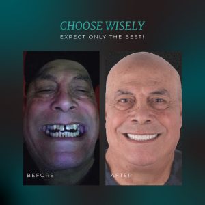 Blog 129 what-do-cavities-look-like