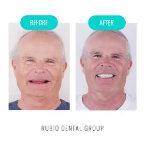 Home 11 before-after-1