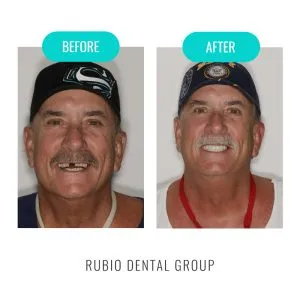 Home 13 before-after-3