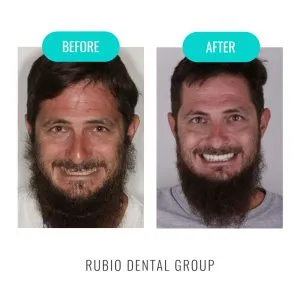 Home 17 best-dentist-in-algodones-mexico-2