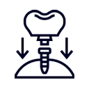 Home 29 same-day-teeth-implants